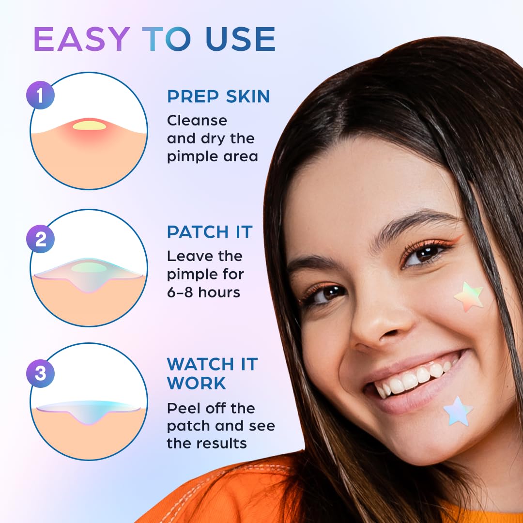 KEYCONCEPTS Star Pimple Patches for Face (100 Pack, Cute), Pimple Patches Stars - Hydrocolloid Star Patches for Pimples with Tea Tree Oil - Star Stickers for Face - Pimple Stickers - Star Acne Patch