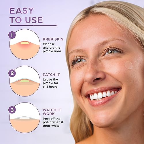 KEYCONCEPTS Pimple Patches (120 Pack), Salicylic Acid Acne Patches with Tea Tree Oil - Pimple Patches for Face - Zit Patch and Pimple Stickers - Salicylic Acid Acne Dots for Acne - Zit Patches