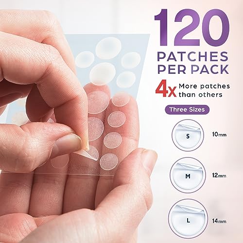 KEYCONCEPTS Pimple Patches (120 Pack), Salicylic Acid Acne Patches with Tea Tree Oil - Pimple Patches for Face - Zit Patch and Pimple Stickers - Salicylic Acid Acne Dots for Acne - Zit Patches
